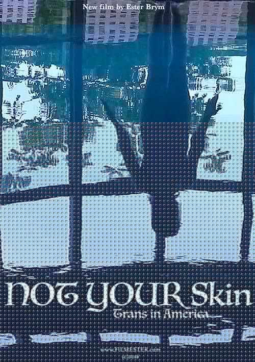 Not Your Skin